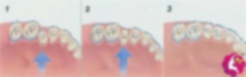 广州圣贝口腔