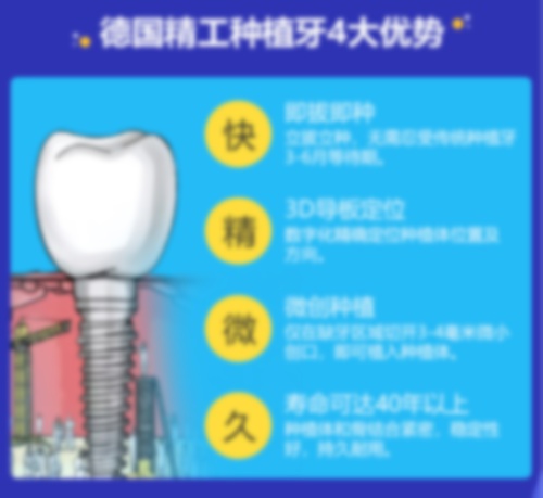 2021种植牙价格表