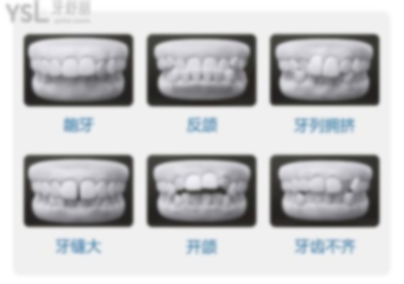 12岁的孩子整牙要多少钱