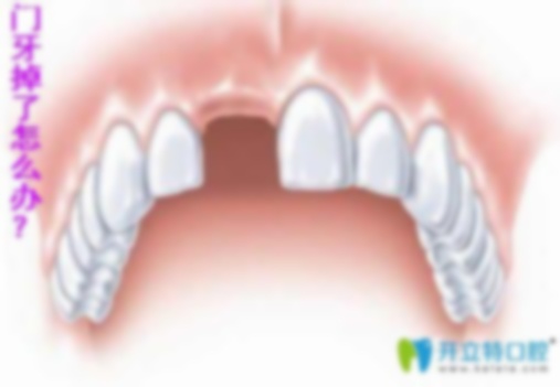 儿童七岁门牙缝隙大怎么办